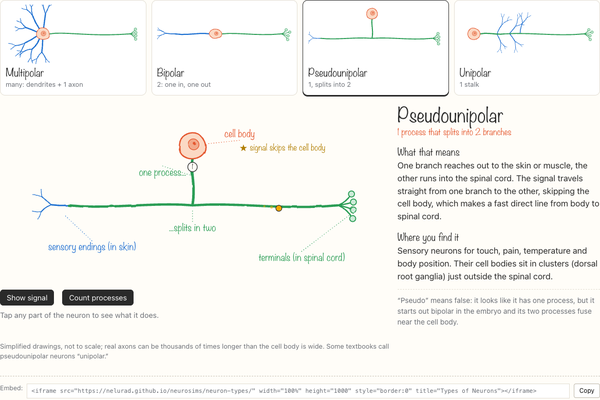 Multipolar, bipolar, pseudounipolar and unipolar neurons side by side